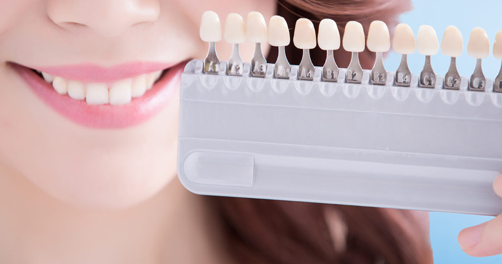 女性目線で提案｜オフィスホワイトニングとホームホワイトニングの特徴と選び方